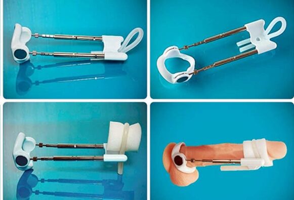 extender for penis enlargement
