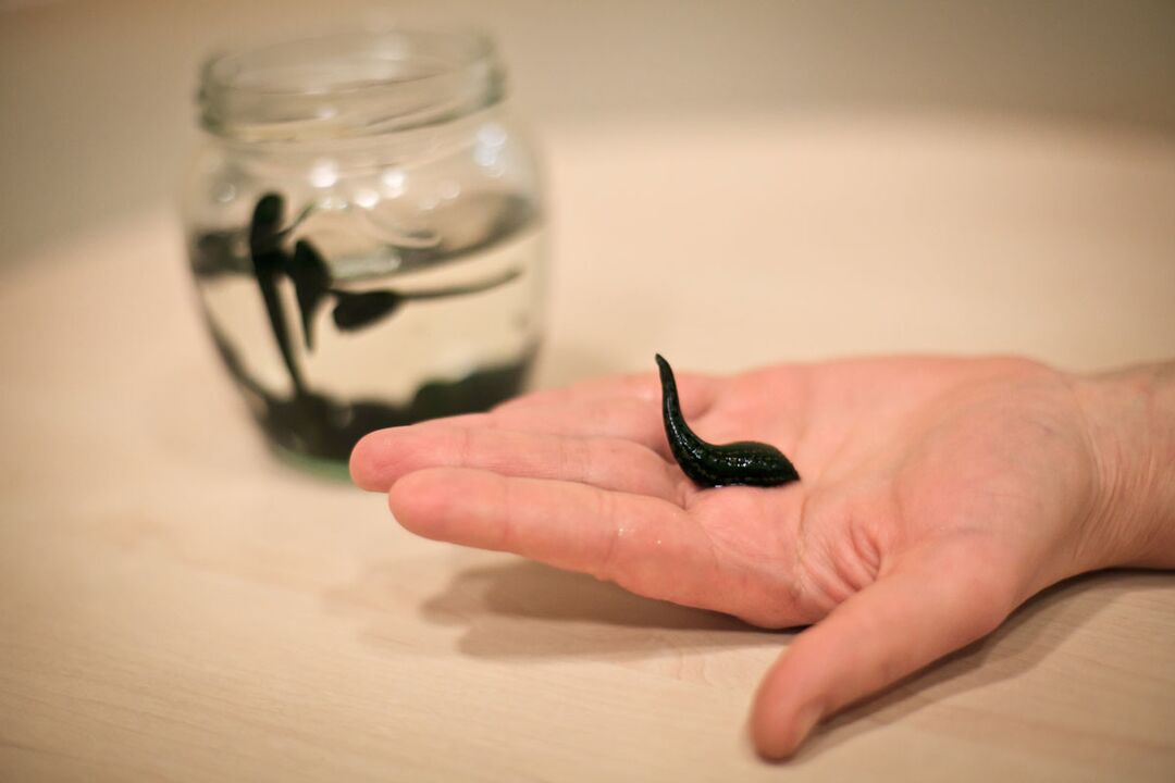 The leeches will serve as a raw material for the production of a cream that stimulates the growth of the penis
