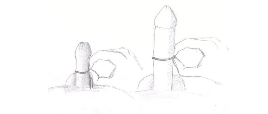 measuring the thickness of the penis